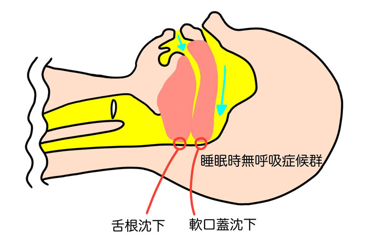 どうやって診断するの?
